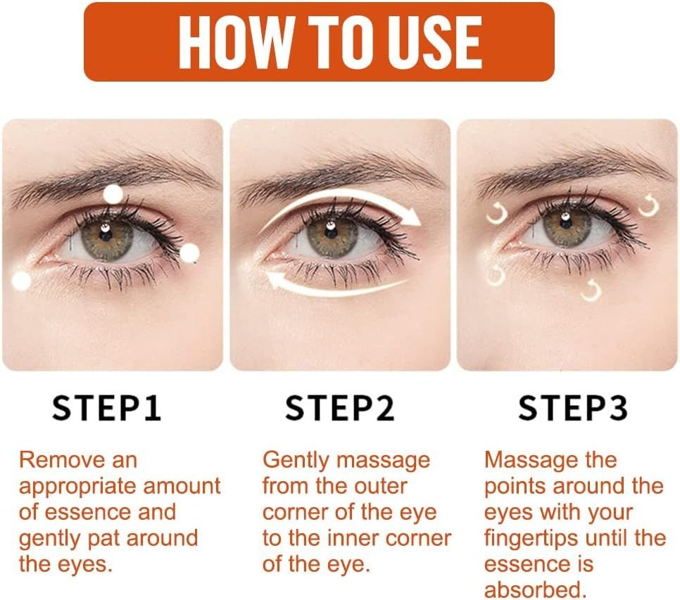 Milia Remover Essential - Cave