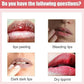Lips Bleaching Cream Balm - Cave