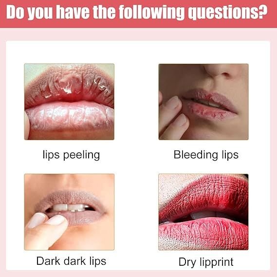Lips Bleaching Cream Balm - Cave