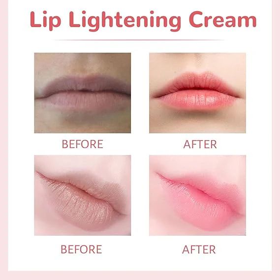 Lips Bleaching Cream Balm - Cave