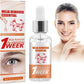 Milia Remover Essential - Cave